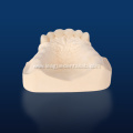 Dental Zirconia Porcelain Veneer